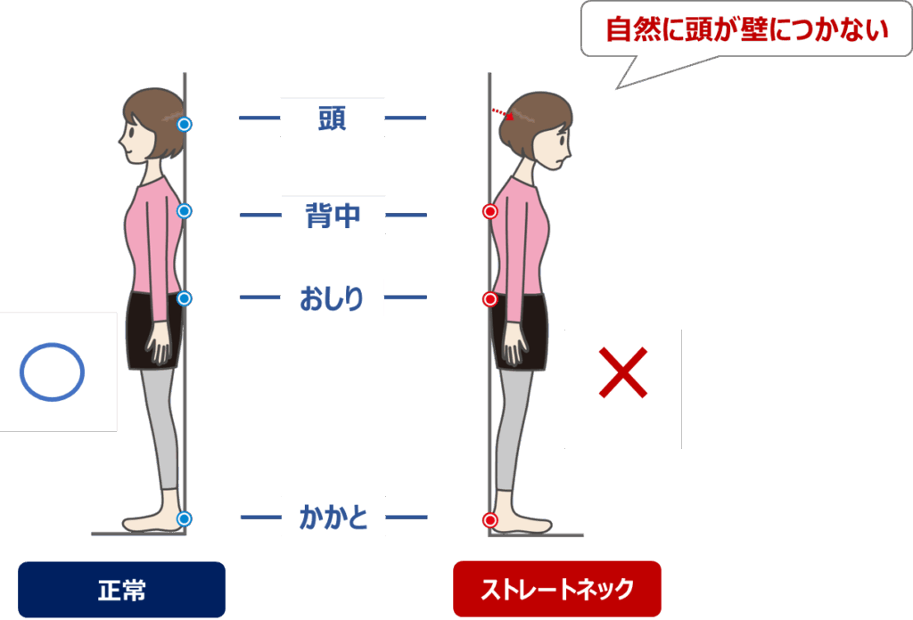 ストレートネック-スマホ首のチェック方法-肩こりの原因