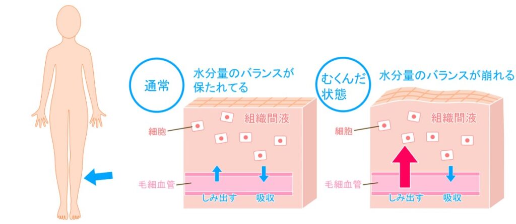 足がむくむメカニズム